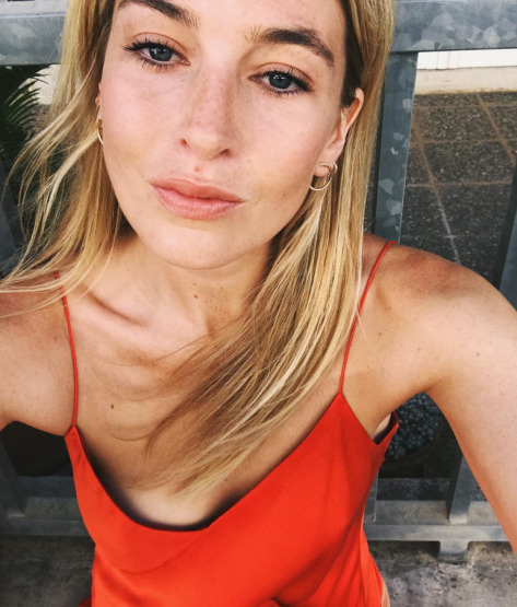 camille-charriere-freckles-beauty-trend